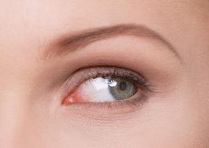 ツムラの小青竜湯は通販で購入できます